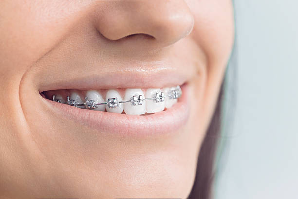 Why Choose Us for Your Dental Needs in Canal Winchester, OH